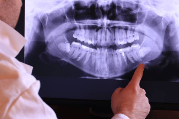 Best Emergency Dental Surgery in Benbrook, TX