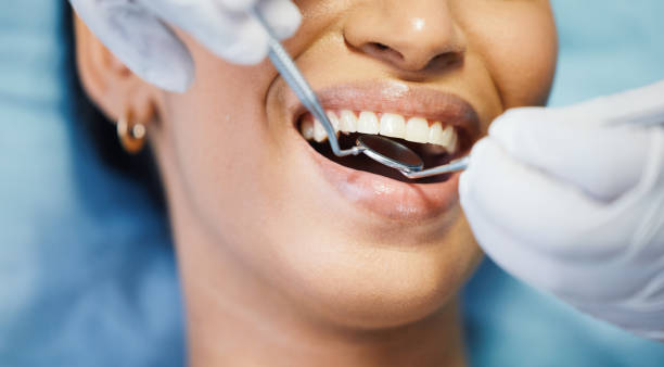 Best Emergency Tooth Extraction in Benbrook, TX