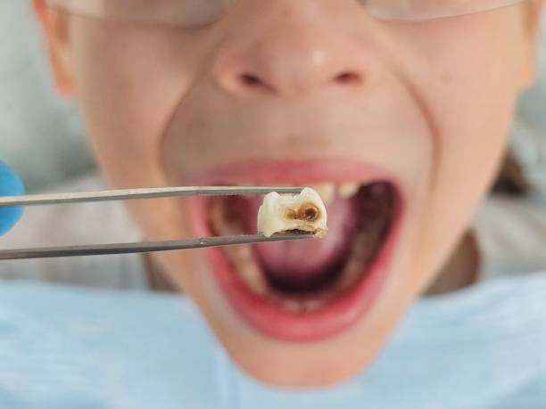 Best Emergency Dental Surgery in Benbrook, TX