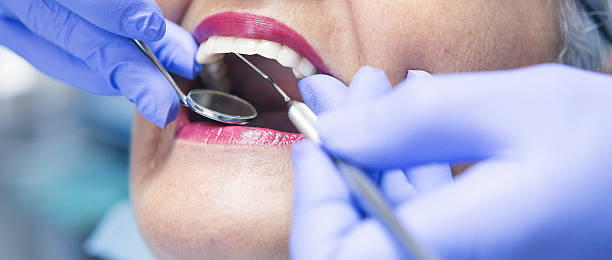 Best Emergency Treatment for Toothache in Benbrook, TX